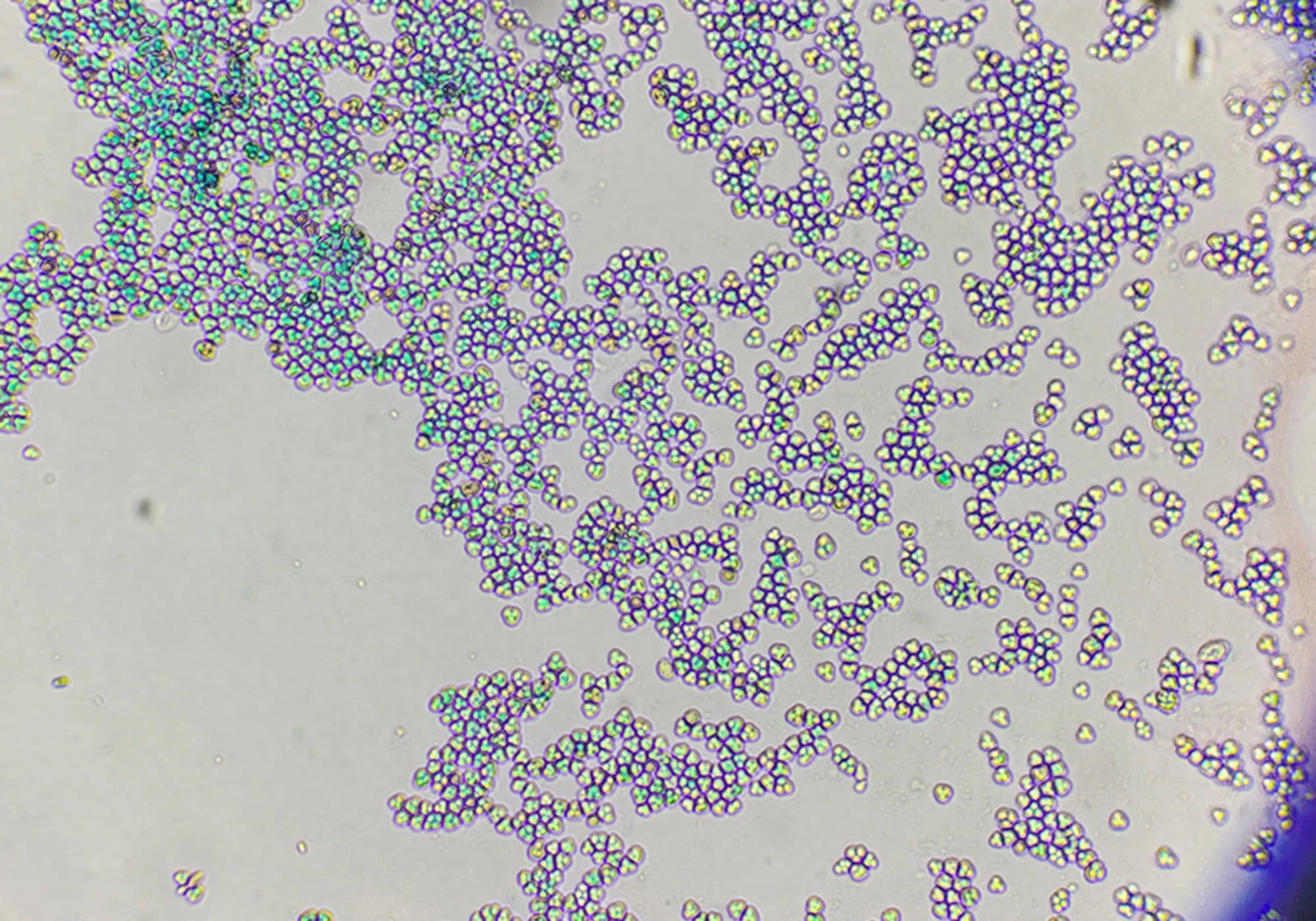 Yeast and Bacteria: Your Flavor Partners in the Distillery